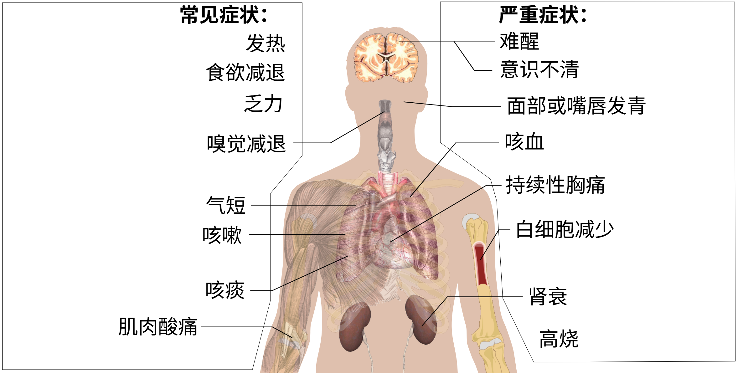 2019冠状病毒病